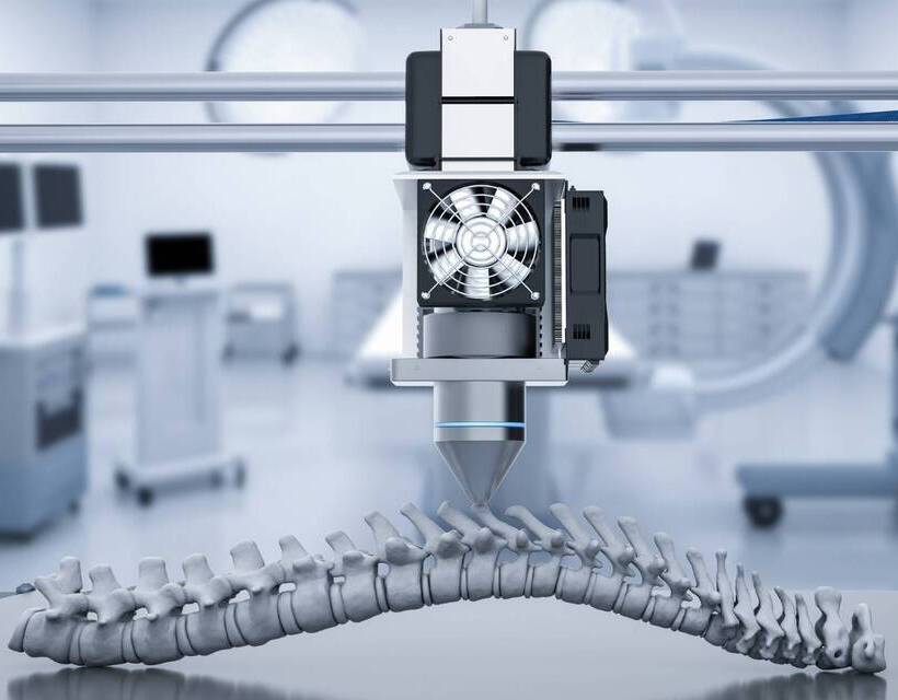 3D Printing in Medical Devices